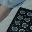 Dévoiler les Secrets du Cancer avec Nouvelles Innovations